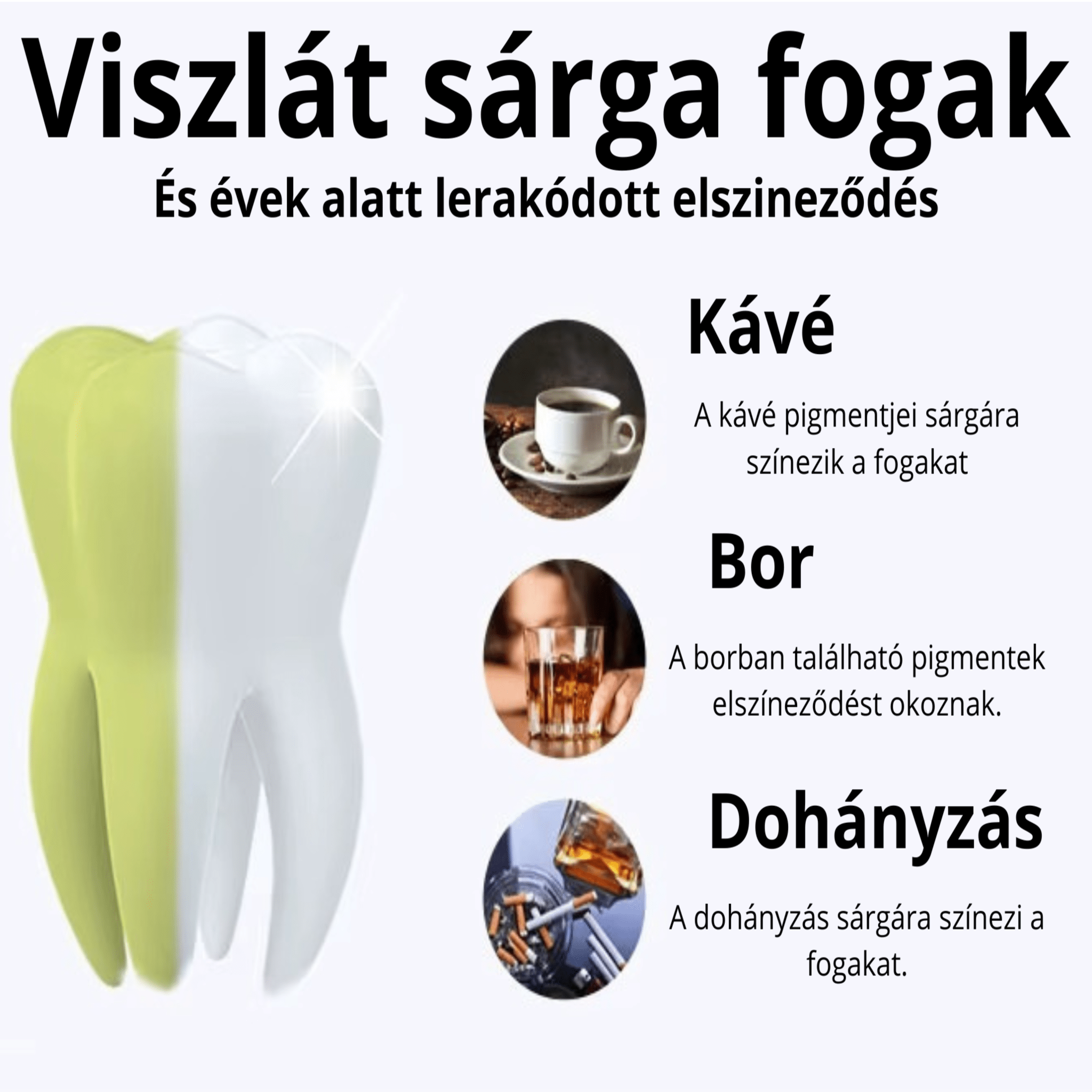 EliteSmile Fogfehérítő Csíkok